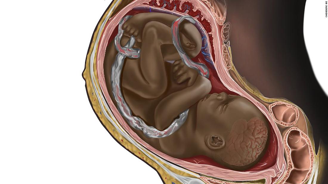 Medical illustration of pregnant Black woman with fetus in womb