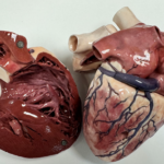 Photo of open heart anatomical model.